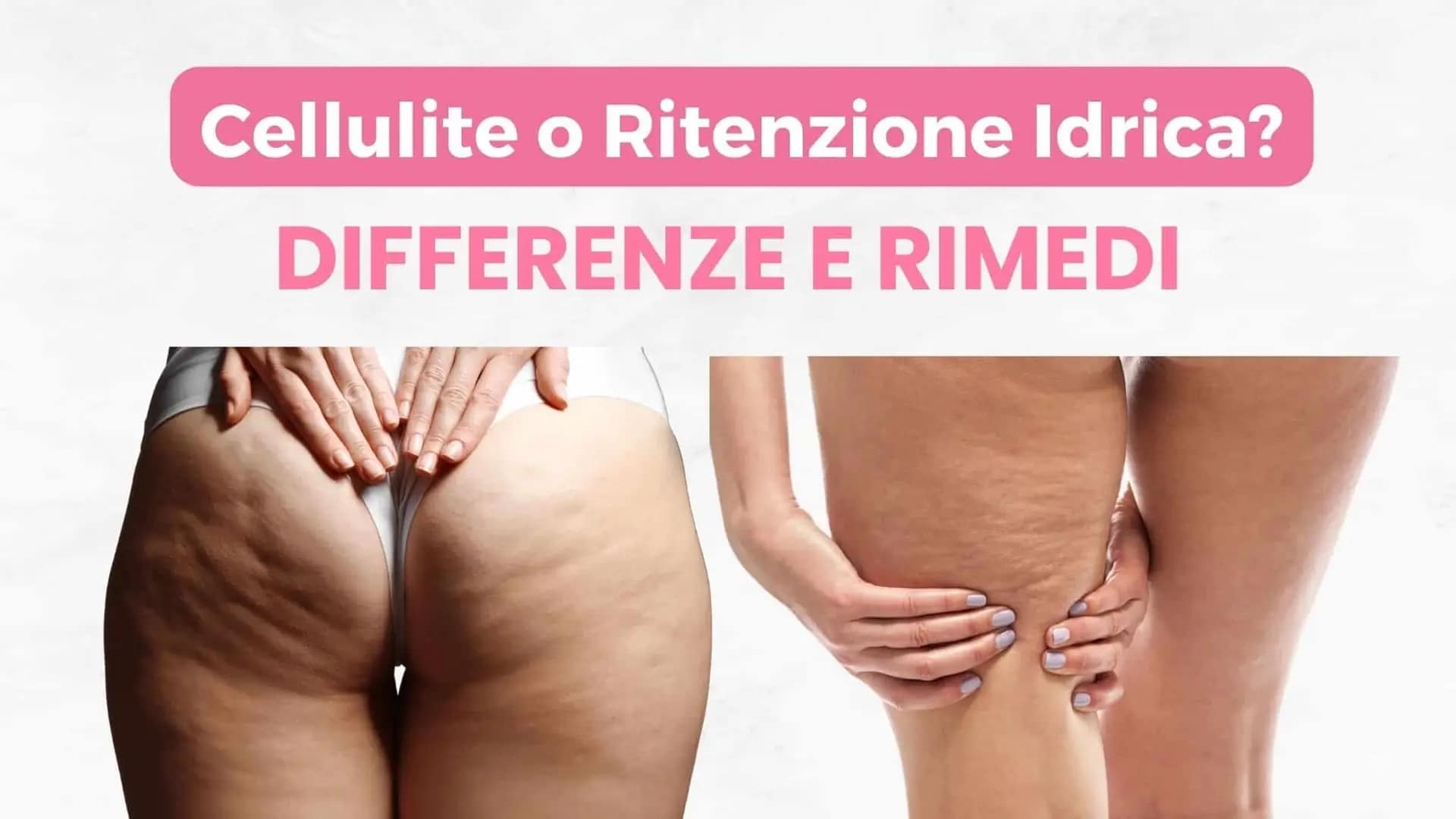 cellulite o ritenzione idrica